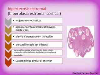 hipertecosis estromal 
(hiperplasia estromal cortical) 
• mujeres menopáusicas 
• agrandamiento uniforme del ovario 
(hasta 7 cm) 
• blanco y bronceado en la sección 
• afectación suele ser bilateral 
• estroma hipercelular y luteinización de las células 
estromales, nidos definidos de células con citoplasma 
vacuolado. 
• Cuadro clinico similar al anterior 
Carolina Campas Sánchez 
 