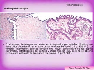 Tumores serosos 
Morfologia Microscopica 
• En el examen histológico los quistes están tapizados por epitelio cilíndrico, que 
tiene cilios abundantes en el caso de los tumores benignos ( fi g. 22-38A ). Los 
tumores intermedios serosos exhiben una mayor complejidad de las papilas 
estromales, estratificación del epitelio y atipia nuclear leve, pero no se observa 
crecimiento infiltrante destructor en el estroma ( fi g. 22-38B ). 
Diana Daniela Gil Díaz 
 