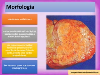 Morfología 
usualmente unilaterales 
varían desde focos microscópicos 
hasta grandes masas macizas o 
quísticas encapsuladas. 
Los tumores con actividad 
hormonal presentan color 
amarillo de las superficies de 
corte, debido a los lípidos 
intracelulares. 
Los tecomas puros son tumores 
macizos firmes. 
Cinthya Lizbeth Fernández Calderón 
 