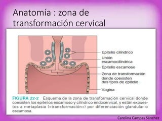 Anatomía : zona de 
transformación cervical 
Carolina Campas Sánchez 
 