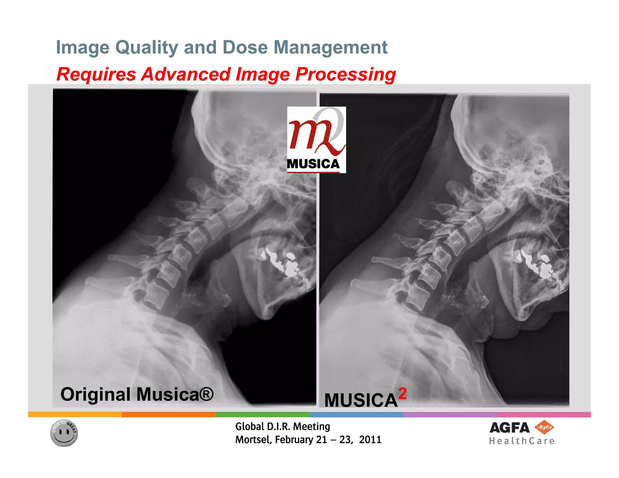 Image Quality and Dose Management
Requires Advanced Image Processing




Original M i ®
O i i l Musica®                     MUSICA2
                  Global D.I.R. Meeting
                  Mortsel, February 21 – 23, 2011
 