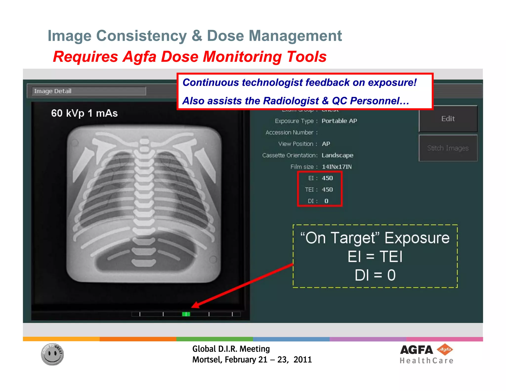 Image Consistency & Dose Management
 Requires Agfa Dose Monitoring Tools
                Continuous technologist feedback on exposure!
                Also assists the Radiologist & QC Personnel…




                 Global D.I.R. Meeting
                 Mortsel, February 21 – 23, 2011
 