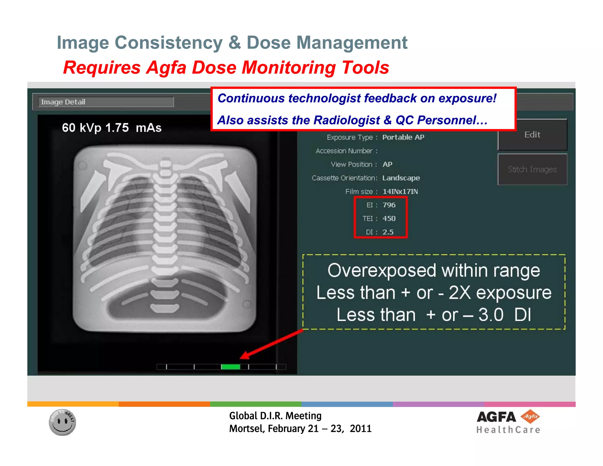 Image Consistency & Dose Management
 Requires Agfa Dose Monitoring Tools
                Continuous technologist feedback on exposure!
                Also assists the Radiologist & QC Personnel…




                 Global D.I.R. Meeting
                 Mortsel, February 21 – 23, 2011
 