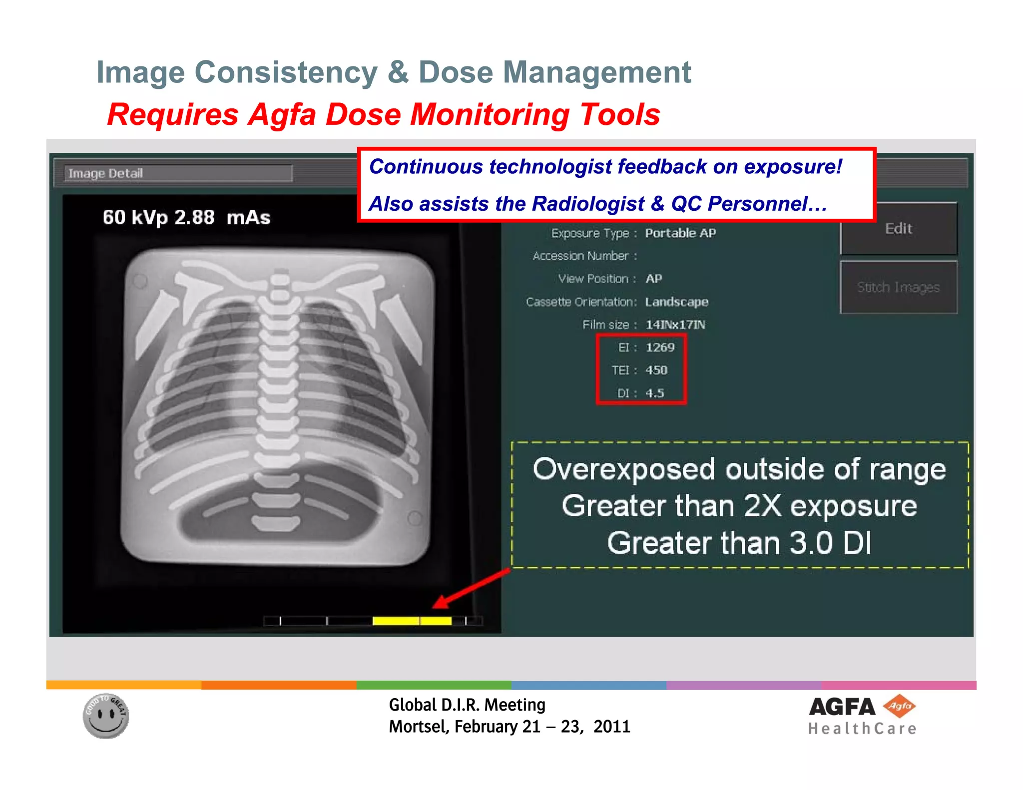 Image Consistency & Dose Management
 Requires Agfa Dose Monitoring Tools
                Continuous technologist feedback on exposure!
                Also assists the Radiologist & QC Personnel…




                 Global D.I.R. Meeting
                 Mortsel, February 21 – 23, 2011
 