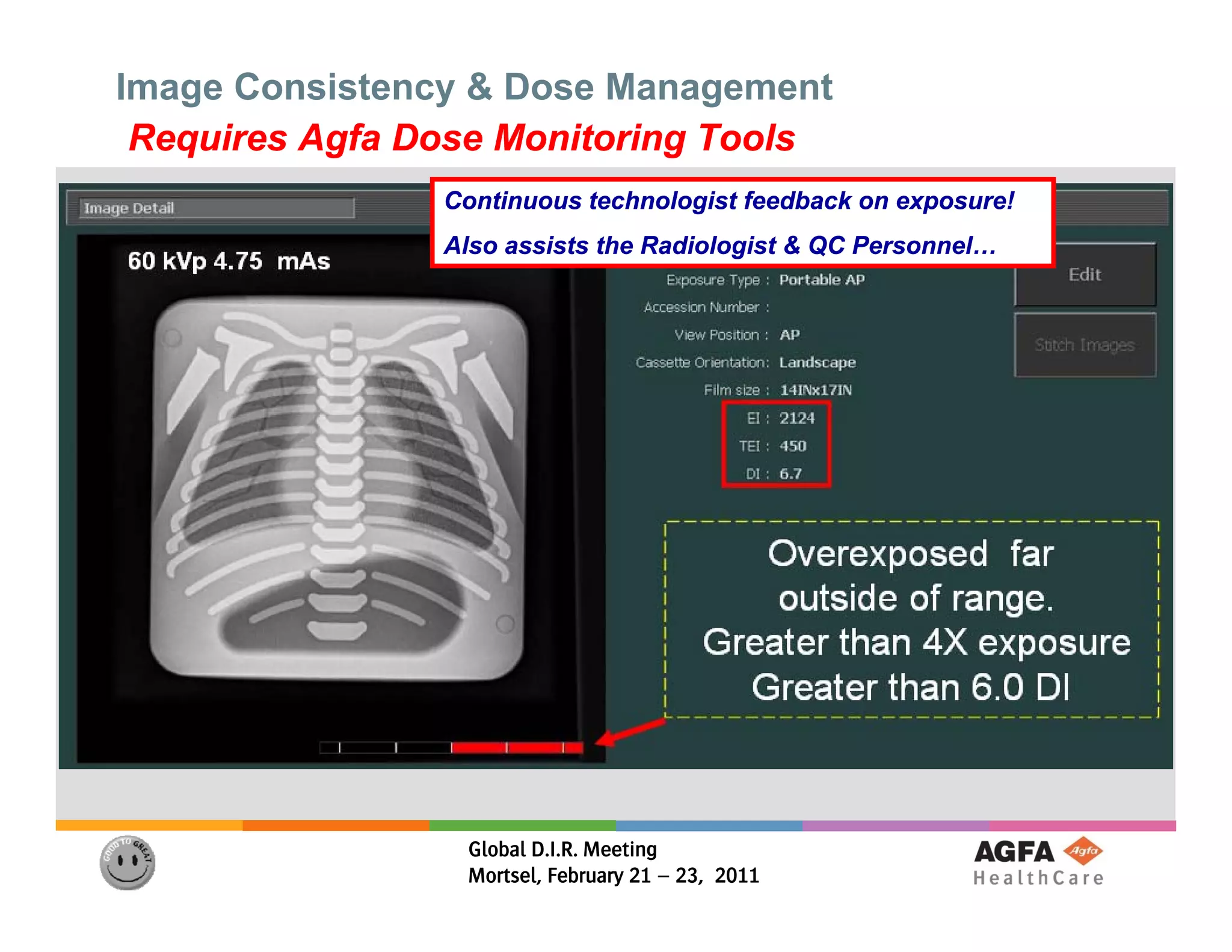 Image Consistency & Dose Management
 Requires Agfa Dose Monitoring Tools
                Continuous technologist feedback on exposure!
                Also assists the Radiologist & QC Personnel…




                 Global D.I.R. Meeting
                 Mortsel, February 21 – 23, 2011
 