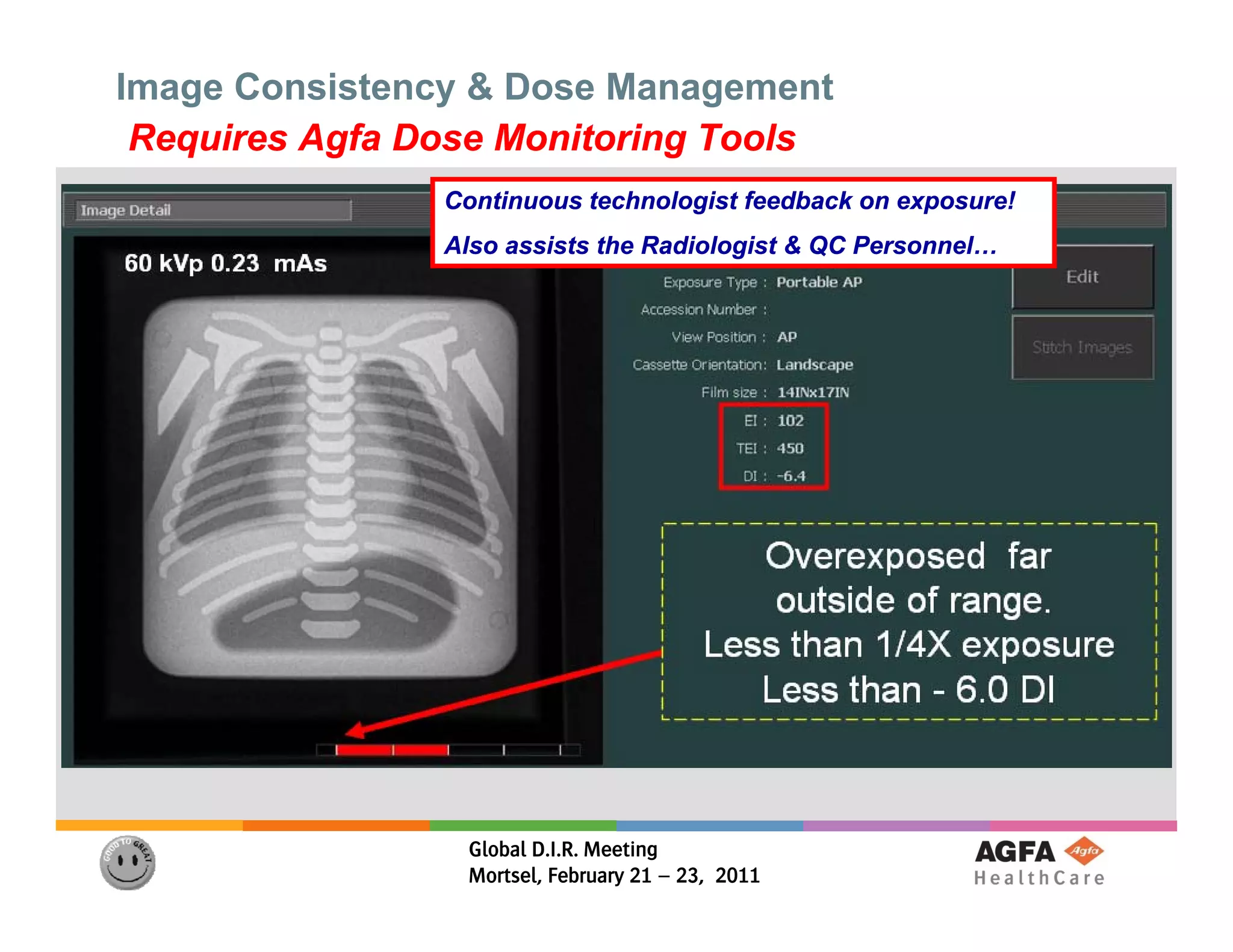 Image Consistency & Dose Management
 Requires Agfa Dose Monitoring Tools
                Continuous technologist feedback on exposure!
                Also assists the Radiologist & QC Personnel…




                 Global D.I.R. Meeting
                 Mortsel, February 21 – 23, 2011
 