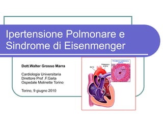 Ipertensione Polmonare e Sindrome di Eisenmenger Dott.Walter Grosso Marra Cardiologia Universitaria Direttore Prof .F.Gaita  Ospedale Molinette Torino Torino, 9 giugno 2010 