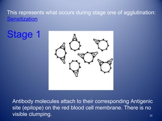 This represents what occurs during stage one of agglutination: 
Sensitization 
Stage 1 
Antibody molecules attach to their corresponding Antigenic 
site (epitope) on the red blood cell membrane. There is no 
visible clumping. 
10 
 
