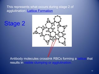 This represents what occurs during stage 2 of 
agglutination: Lattice Formation 
Stage 2 
Antibody molecules crosslink RBCs forming a lattice that 
results in visible clumping or agglutination. 
11 
 