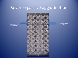 Reverse passive agglutination 
Negative 
Positive 
 