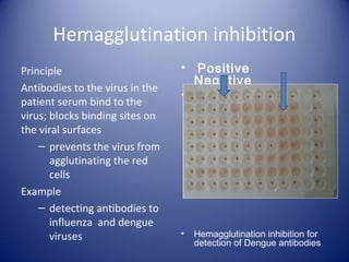 Hemagglutination inhibition 
Principle 
Antibodies to the virus in the 
patient serum bind to the 
virus; blocks binding sites on 
the viral surfaces 
– prevents the virus from 
agglutinating the red 
cells 
Example 
– detecting antibodies to 
influenza and dengue 
viruses 
• Positive 
Negative 
• 
• Hemagglutination inhibition for 
detection of Dengue antibodies 
 