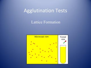 Agglutination Tests 
Lattice Formation 
 