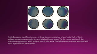 Antibodies against six different serovars of Group A strep were attached to latex beads. Each of the six
antibody preparations was mixed with bacteria isolated from a patient. The tiny clumps seen in well 4 are
indicative of agglutination, which is absent from all other wells. This indicates that the serovar associated with
well 4 is present in the patient sample.
 