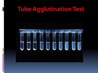 Tube AgglutinationTest
 