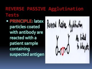  PRINCIPLE: latex
particles coated
with antibody are
reacted with a
patient sample
containing
suspected antigen
 