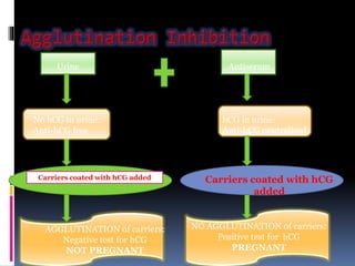 Urine Antiserum
No hCG in urine:
Anti-hCG free
hCG in urine:
Anti-hCG neutralized
Carriers coated with hCG added Carriers coated with hCG
added
AGGLUTINATION of carriers:
Negative test for hCG
NOT PREGNANT
NO AGGLUTINATION of carriers:
Positive test for hCG
PREGNANT
 