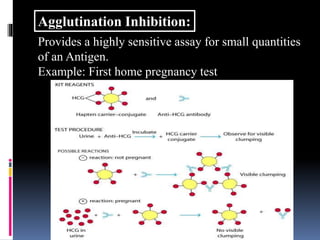 Provides a highly sensitive assay for small quantities
of an Antigen.
Example: First home pregnancy test
Agglutination Inhibition:
 
