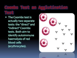  The Coombs test is
actually two separate
tests: the "direct" and
"indirect" Coombs
tests. Both aim to
identify autoimmune
haemolysis of red
blood cells
(erythrocytes).
 