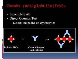 • Incomplete Ab
• Direct Coombs Test
– Detects antibodies on erythrocytes
+ ↔
Patient’s RBCs Coombs Reagent
(Antiglobulin)
 