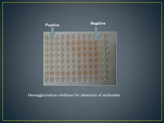 Positive Negative
Hemagglutination inhibition for detection of antibodies
 