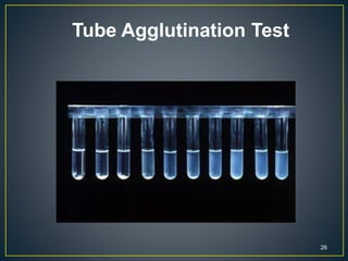 26
Tube Agglutination Test
 