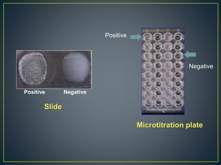 Negative
Positive
Positive Negative
Slide
Microtitration plate
 