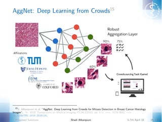 AggNet: Deep Learning from Crowds15
15
S. Albarqouni et al. “AggNet: Deep Learning from Crowds for Mitosis Detection in Breast Cancer Histology
Images”. In: IEEE Transactions on Medical Imaging PP.99 (2016), pp. 1–1. issn: 0278-0062. doi:
10.1109/TMI.2016.2528120.
Proposed Solutions Shadi Albarqouni 5-7th April 16 25 / 42
 
