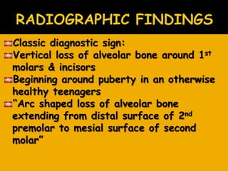 Classic diagnostic sign:
Vertical loss of alveolar bone around 1st
molars & incisors
Beginning around puberty in an otherwise
healthy teenagers
―Arc shaped loss of alveolar bone
extending from distal surface of 2nd
premolar to mesial surface of second
molar‖
 