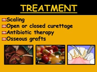 Scaling
Open or closed curettage
Antibiotic therapy
Osseous grafts
 