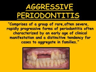 ―Comprises of a group of rare,often severe,
rapidly progressive forms of periodontitis often
characterized by an early age of clinical
manifestation and a distinctive tendency for
cases to aggregate in families.‖
 