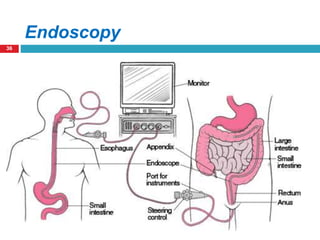36 
Endoscopy 
 