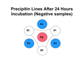 Precipitin Lines After 24 Hours
Incubation (Negative samples)

              As

       #3            #1

              Ag

        As           As

              #2
 
