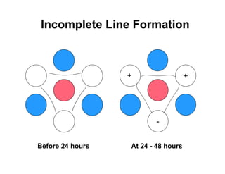 Incomplete Line Formation



                  +                  +




                         -


Before 24 hours   At 24 - 48 hours
 