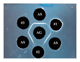 AS

#3        #1

     AG

AS        AS

     #2
 