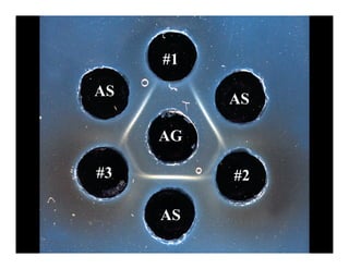 #1
AS        AS

     AG

#3        #2

     AS
 