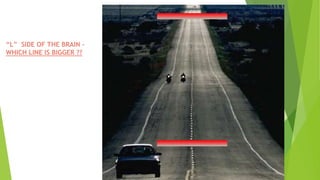 “L” SIDE OF THE BRAIN -
WHICH LINE IS BIGGER ??
 