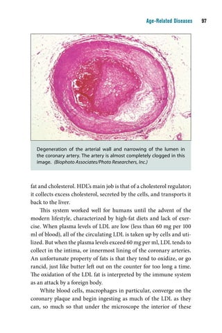 Age-Related Diseases    




  Degeneration of the arterial wall and narrowing of the lumen in
  the coronary artery. The artery is almost completely clogged in this
  image. (Biophoto Associates/Photo Researchers, Inc.)



fat and cholesterol. HDL’s main job is that of a cholesterol regulator;
it collects excess cholesterol, secreted by the cells, and transports it
back to the liver.
     This system worked well for humans until the advent of the
modern lifestyle, characterized by high-fat diets and lack of exer-
cise. When plasma levels of LDL are low (less than 60 mg per 100
ml of blood), all of the circulating LDL is taken up by cells and uti-
lized. But when the plasma levels exceed 60 mg per ml, LDL tends to
collect in the intima, or innermost lining of the coronary arteries.
An unfortunate property of fats is that they tend to oxidize, or go
rancid, just like butter left out on the counter for too long a time.
The oxidation of the LDL fat is interpreted by the immune system
as an attack by a foreign body.
     White blood cells, macrophages in particular, converge on the
coronary plaque and begin ingesting as much of the LDL as they
can, so much so that under the microscope the interior of these
 