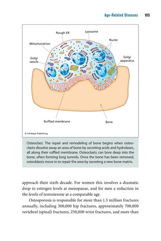 Age-Related Diseases    10



                         Rough ER       Lysosome

                                                        Nuclei
     Mitochondrion



      Golgi                                                        Golgi
     vesicle                                                     apparatus




                  Rufﬂed membrane                     Bone


 © Infobase Publishing



  Osteoclast. The repair and remodeling of bone begins when osteo-
  clasts dissolve away an area of bone by secreting acids and hydrolases,
  all along their ruffled membrane. Osteoclasts can bore deep into the
  bone, often forming long tunnels. Once the bone has been removed,
  osteoblasts move in to repair the area by secreting a new bone matrix.




approach their sixth decade. For women this involves a dramatic
drop in estrogen levels at menopause, and for men a reduction in
the levels of testosterone at a comparable age.
    Osteoporosis is responsible for more than 1.5 million fractures
annually, including 300,000 hip fractures, approximately 700,000
vertebral (spinal) fractures, 250,000 wrist fractures, and more than
 