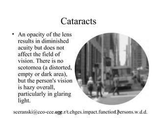 Cataracts
• An opacity of the lens
  results in diminished
  acuity but does not
  affect the field of
  vision. There is no
  scotomoa (a distorted,
  empty or dark area),
  but the person's vision
  is hazy overall,
  particularly in glaring
  light.
sceranski@cco-cce.org
                  age.r/t.chges.impact.function.persons.w.d.d.
                                              17
 