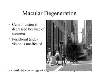 Macular Degeneration
• Central vision is
  decreased because of
  scotoma
• Peripheral (side)
  vision is unaffected




sceranski@cco-cce.org
                  age.r/t.chges.impact.function.persons.w.d.d.
                                              18
 