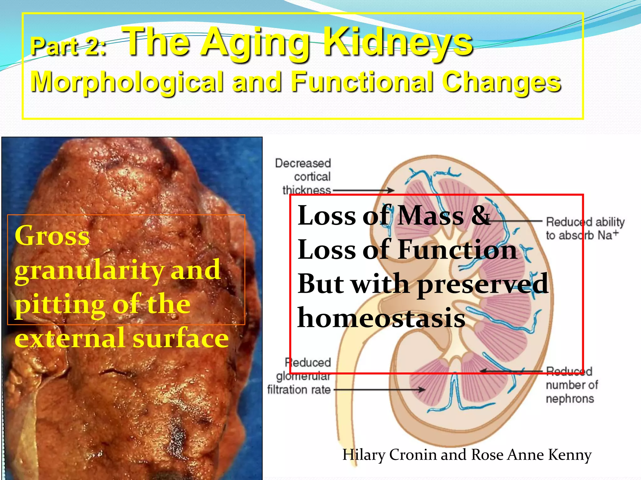 Hilary Cronin and Rose Anne Kenny
Part 2: The Aging Kidneys
Morphological and Functional Changes
Gross
granularity and
pitting of the
external surface
Loss of Mass &
Loss of Function
But with preserved
homeostasis