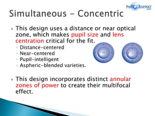 Centration Distance The Right Contact | PPTX