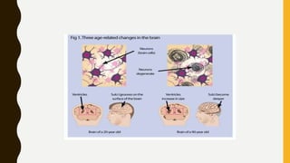 Aging in central nervous system.pptx