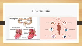 Comprehensive Overview of Aging Effects on the Human Digestive System | PDF