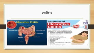 Comprehensive Overview of Aging Effects on the Human Digestive System | PDF