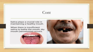 Comprehensive Overview of Aging Effects on the Human Digestive System | PDF
