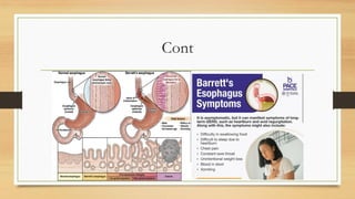 Comprehensive Overview of Aging Effects on the Human Digestive System | PDF