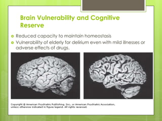 Brain Vulnerability and Cognitive
Reserve
 Reduced capacity to maintain homeostasis
 Vulnerability of elderly for delirium even with mild illnesses or
adverse effects of drugs.
 