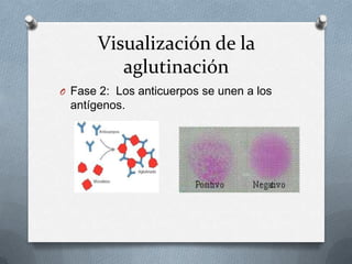 Visualización de la
aglutinación
O Fase 2: Los anticuerpos se unen a los
antígenos.
 