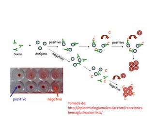 Tomada de: 
http://epidemiologiamolecular.com/reacciones-hemaglutinacion- 
lisis/ 
 